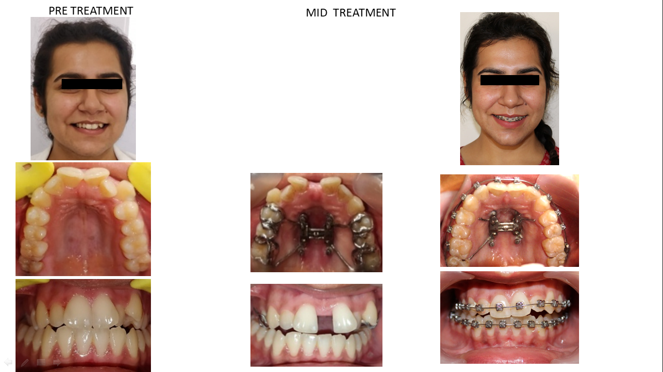 Orthodontics & Dentofacial Orthopaedics